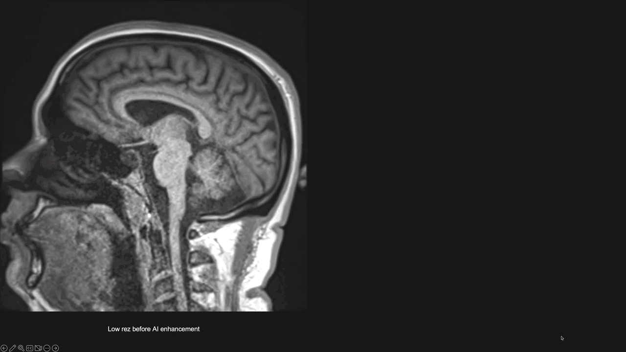 Animated demonstration of Ezra's AI enhancement of a brain MRI.